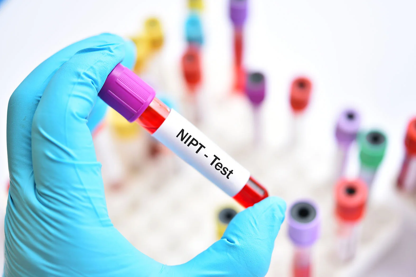 Empowering Your Pregnancy NIPT Test Life Aid